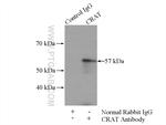 CRAT Antibody in Immunoprecipitation (IP)