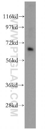 CRAT Antibody in Western Blot (WB)