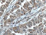 GPI Antibody in Immunohistochemistry (Paraffin) (IHC (P))