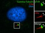 gamma Tubulin Antibody in Immunocytochemistry (ICC/IF)