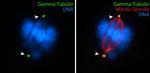 gamma Tubulin Antibody in Immunocytochemistry (ICC/IF)