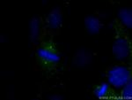 gamma Tubulin Antibody in Immunocytochemistry (ICC/IF)