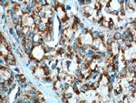 gamma Tubulin Antibody in Immunohistochemistry (Paraffin) (IHC (P))