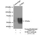 gamma Tubulin Antibody in Immunoprecipitation (IP)