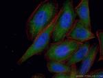 RBPMS Antibody in Immunocytochemistry (ICC/IF)