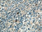 MRPL37 Antibody in Immunohistochemistry (Paraffin) (IHC (P))