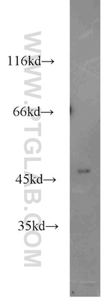 MRPL37 Antibody in Western Blot (WB)