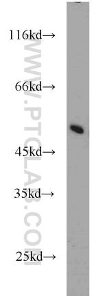 MRPL37 Antibody in Western Blot (WB)