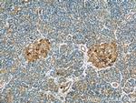 COL4A3BP Antibody in Immunohistochemistry (Paraffin) (IHC (P))