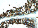 CD98 Antibody in Immunohistochemistry (Paraffin) (IHC (P))