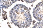 CD98 Antibody in Immunohistochemistry (Paraffin) (IHC (P))