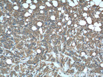 DHFR Antibody in Immunohistochemistry (Paraffin) (IHC (P))