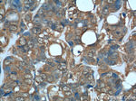 DHFR Antibody in Immunohistochemistry (Paraffin) (IHC (P))