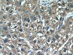 DHFR Antibody in Immunohistochemistry (Paraffin) (IHC (P))