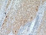 DHFR Antibody in Immunohistochemistry (Paraffin) (IHC (P))