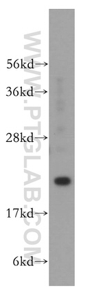 DHFR Antibody in Western Blot (WB)