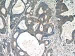 RPS3 Antibody in Immunohistochemistry (Paraffin) (IHC (P))