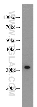 RPS3 Antibody in Western Blot (WB)