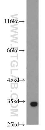 RPS3 Antibody in Western Blot (WB)