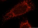 TMP21 Antibody in Immunocytochemistry (ICC/IF)