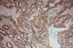 TMP21 Antibody in Immunohistochemistry (Paraffin) (IHC (P))