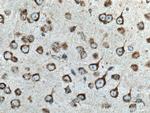 TMP21 Antibody in Immunohistochemistry (Paraffin) (IHC (P))