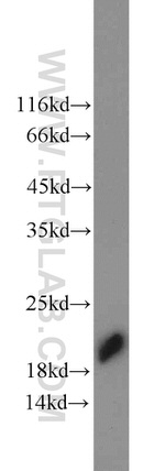 TMP21 Antibody in Western Blot (WB)