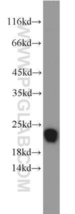 TMP21 Antibody in Western Blot (WB)