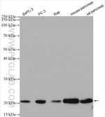 TMP21 Antibody in Western Blot (WB)