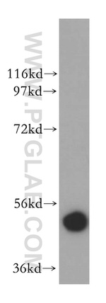 B4GALT4 Antibody in Western Blot (WB)