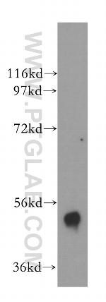 B4GALT4 Antibody in Western Blot (WB)