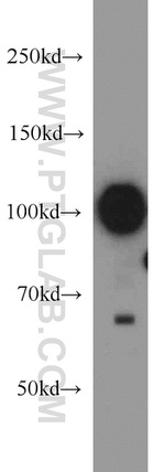 KAP1 Antibody in Western Blot (WB)