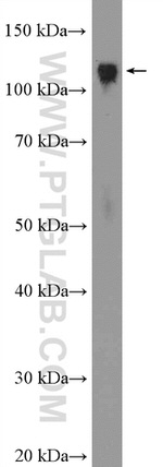 KAP1 Antibody in Western Blot (WB)