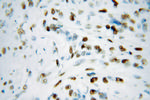 KAP1 Antibody in Immunohistochemistry (Paraffin) (IHC (P))