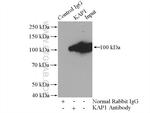 KAP1 Antibody in Immunoprecipitation (IP)