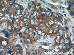 CHOP Antibody in Immunohistochemistry (Paraffin) (IHC (P))