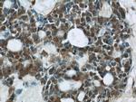 CHOP Antibody in Immunohistochemistry (Paraffin) (IHC (P))