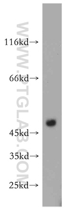 FADS3 Antibody in Western Blot (WB)