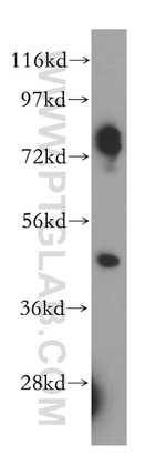 CRACR2A Antibody in Western Blot (WB)