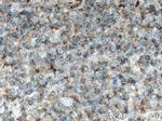 CRACR2A Antibody in Immunohistochemistry (Paraffin) (IHC (P))