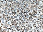 OGDH Antibody in Immunohistochemistry (Paraffin) (IHC (P))