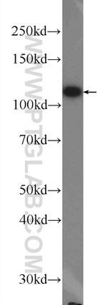 OGDH Antibody in Western Blot (WB)