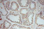 GSTM3 Antibody in Immunohistochemistry (Paraffin) (IHC (P))