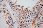 GSTM3 Antibody in Immunohistochemistry (Paraffin) (IHC (P))