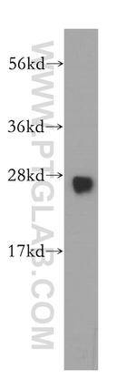 GSTM3 Antibody in Western Blot (WB)