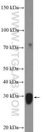 GSTM3 Antibody in Western Blot (WB)