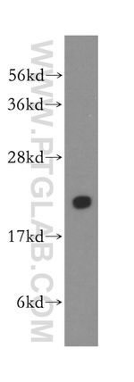 PTGES3 Antibody in Western Blot (WB)