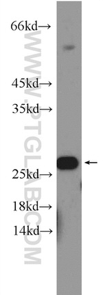 RPB5 Antibody in Western Blot (WB)