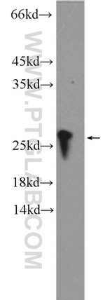 RPB5 Antibody in Western Blot (WB)