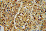 PSMA7 Antibody in Immunohistochemistry (Paraffin) (IHC (P))